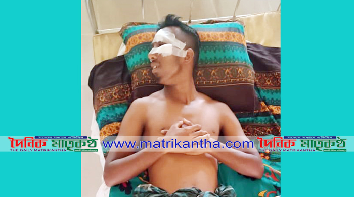 গোয়ালন্দের উজানচরে তুচ্ছ ঘটনায় এক যুবককে কুপিয়ে গুরুতর জখম